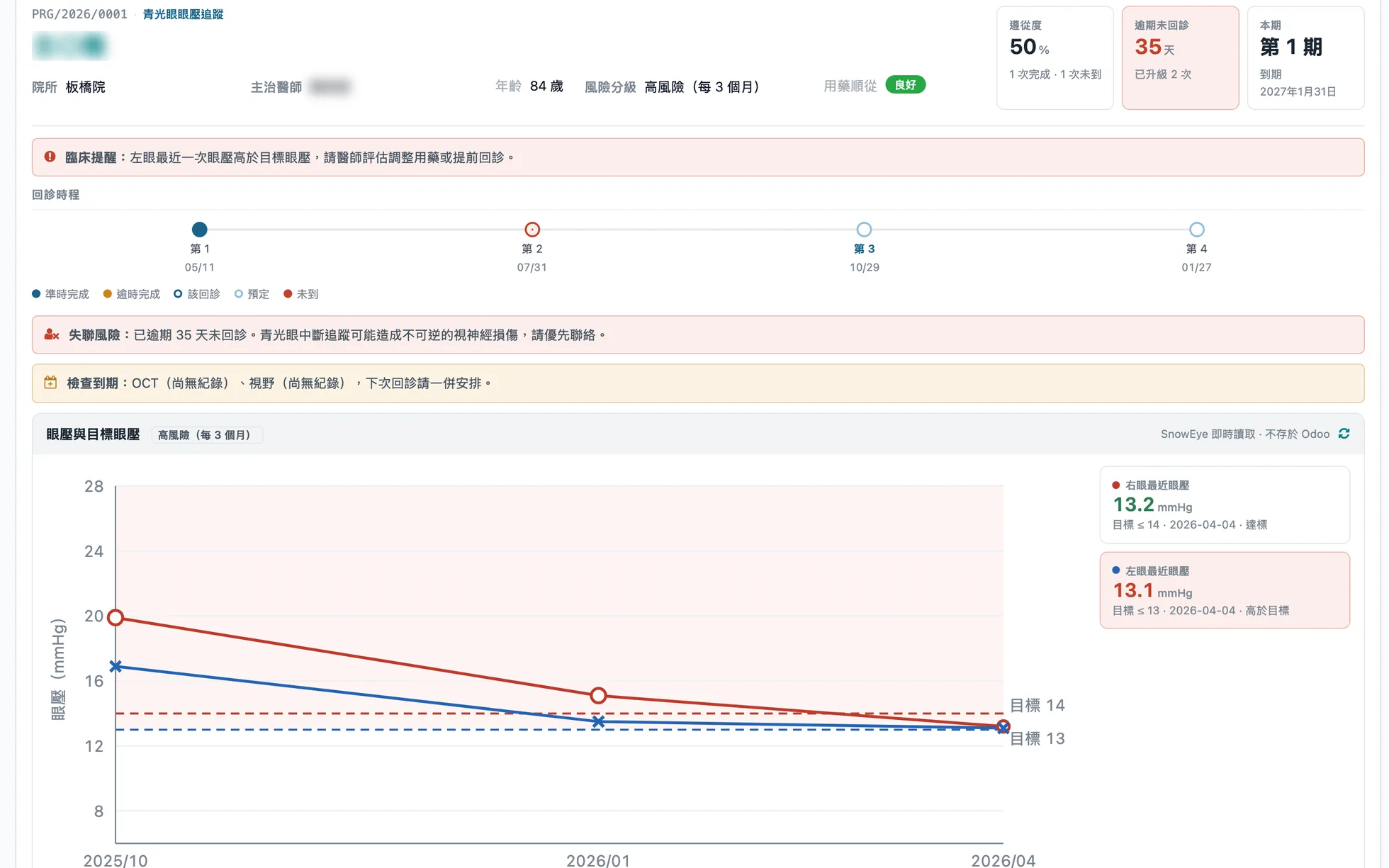 青光眼收案：風險分級、臨床提醒、失聯風險、OCT 與視野到期，以及左右眼眼壓對照目標眼壓（姓名與醫師已模糊）