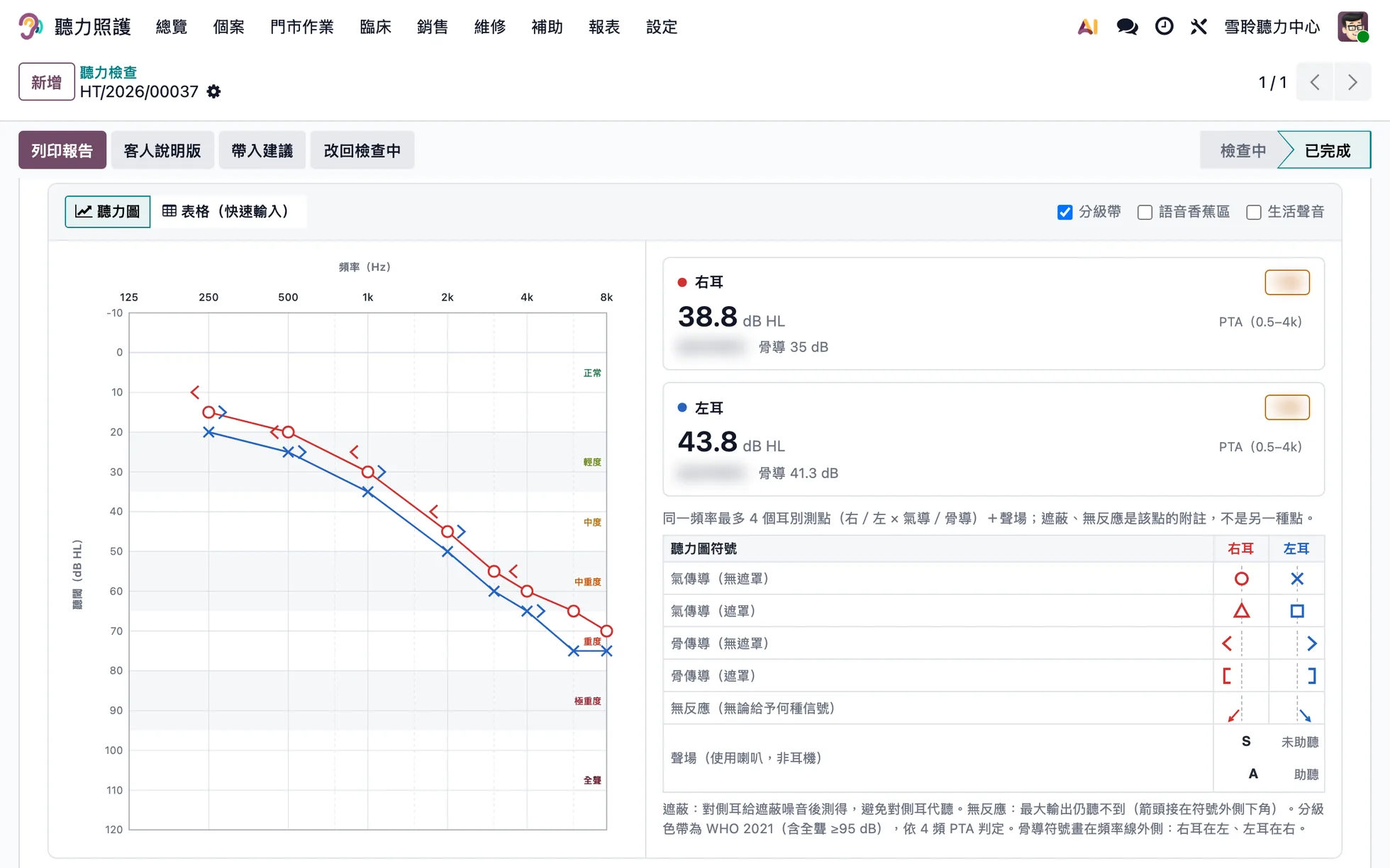 聽力檢查畫面:純音聽力圖(氣導、骨導符號)與左右耳 PTA,分級文字已模糊(示範資料)